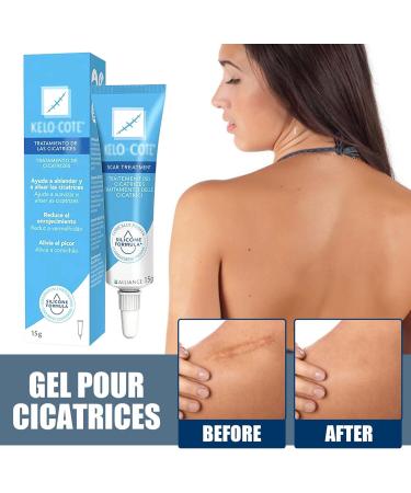 Scar Ointment 15g - Reduces Visibility of Scars | Effective Scar Gel & Cream for Faster Healing - Buy Online on GoSupps.com