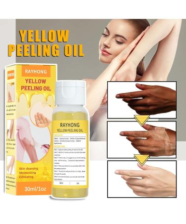 Extra Strength Yellow Peeling Oil 30ML - Lighten Dark Spots, Brighten Complexion - For Face & Body - Suitable for Dark Skin - Buy Online on GoSupps.com
