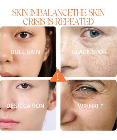 Super Dark Spot Correcting Glow Serum - Vitamin C Serum for Women - Anti-Aging Retinol Face Serum - Hyaluronic Acid Moisturizes Skin - Leave Skin Smooth 30ml - Buy Online on GoSupps.com