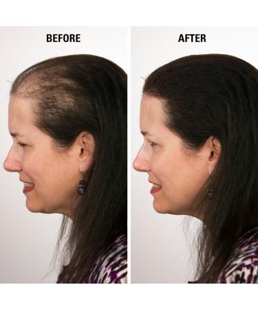 Infinity Hair Fiber - Hair Loss Concealer for Men & Women - Dark Brown 30g - Buy Online on GoSupps.com
