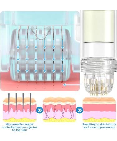 Glamroy Micro Infusion System Glamorys Micro Infusion System for Face Glamorys Micro Infusion System for Lips Glamorys Micro System For Face Gla-mory Micro Infusion System With Serum Gla-mory Micro Infusion System for Face Gla-mory Facial Serum - Buy Online on GoSupps.com