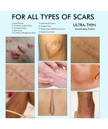 Reusable Medical Grade Silicone Scar Tape - 4cm x 3m Roll for Acne, C-Section, Keloid & Surgery Scars - Buy Online on GoSupps.com
