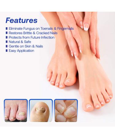 Treatonic Extra Strength Toe Nail Fungus Treatment - Fast Acting Cure for Toenail Fungus - 4 Count Pack - Buy Online on GoSupps.com