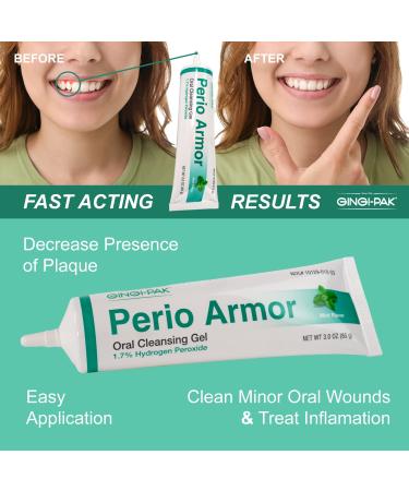 Perio Armor 1.7% HP Oral Cleansing Gel - Healthy Gums Whiter Smile Non-Invasive Strawberry Treatment 3 oz | Buy Internationally - Buy Online on GoSupps.com