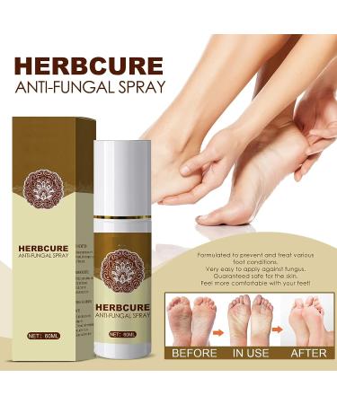 Fungal Combat Feet Spray- 3 Pcs Anti-Fungal Infections Athlete's Foot Herbal Peeling Spray 60ml - Buy Online on GoSupps.com
