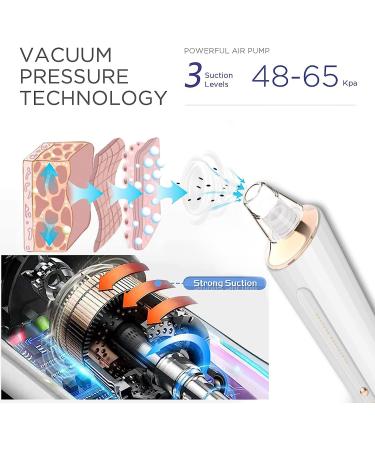 USB Rechargeable Blackhead Remover Pore Vacuum Kit - 3 Suction Power - Facial Pore Cleaner for Men & Women (White) - Buy Online on GoSupps.com