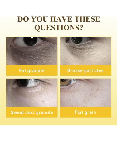 KOAHDE Moisturizing Milia Eyes Cream Speedy Milia Remover Eye Cream Smooth Milia Eyes Cream Milia Removal Eye Creams Dissolve and Reduce Milia Eye Cream Dark Circles Remover Lightens Cream 50G - Buy Online on GoSupps.com