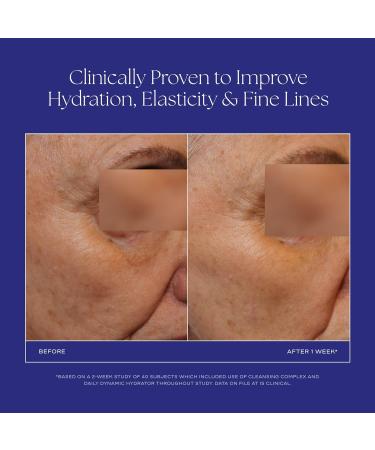 iS CLINICAL Daily Dynamic Hydrator Hydrating Anti-Aging Face Moisturizer with Hyaluronic Acid Repairs and Protects Skin Powered by GeneXC Technology - Buy Online on GoSupps.com