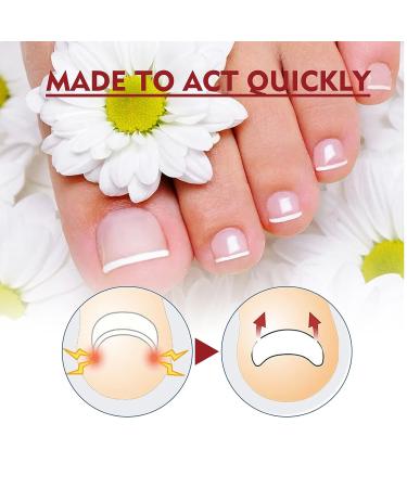 German Toenailplus & NailPro Anti Paronychia Relief Oil Set for Damaged Nails - Buy Online on GoSupps.com