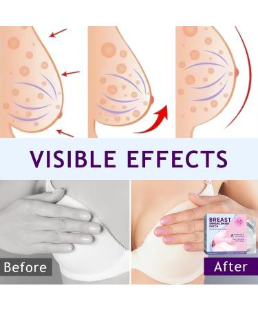 Breast Enhancement Patch Natural Lifter & Firming Solution for Sagging Breasts - Buy Online on GoSupps.com