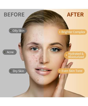 Turmeric Jelly Mask Powder for Facials - Anti-Wrinkle & Acne Removal Professional Peel Off Hydro Mask - 23 FL OZ - Buy Online on GoSupps.com