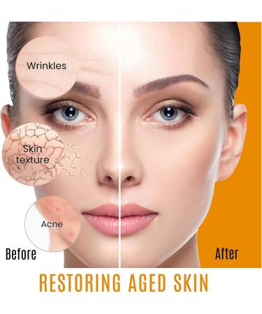 Vitamin C Moisturiser for Face Vitamin C Suspension 30% - Face Moisturiser to Nourish Skin Smooth Lines & Boost Glow Vitamin C Cream Day and Night Anti Aging Face Cream 1 oz/ 30 mL - Buy Online on GoSupps.com