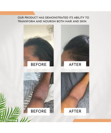 Batanaful Pure Batana Oil for Hair Growth Oil Body Oil for Dry Skin Scalp Oil for Dry Itchy Scalp Split Ends Repair Hair Loss Treatment for Women Men - 100 ml - Buy Online on GoSupps.com