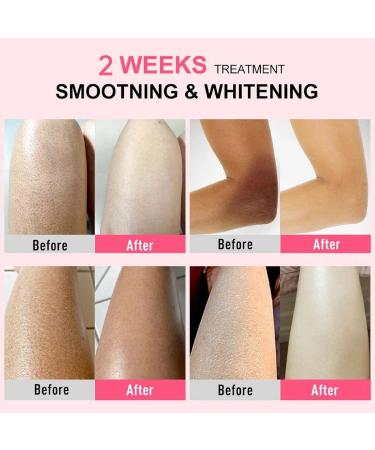 Skin Exfoliating Repair Cream Chicken Skin Care Cream Strawberry Legs Treatment Body Cream - Buy Online on GoSupps.com