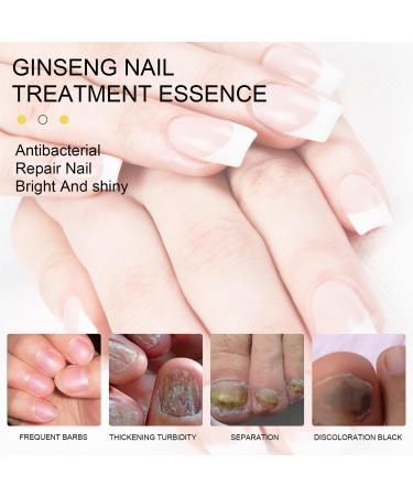  MagiSel Nail strengthening nail strengthening polish nail care oil with ginseng oil repairs and strengthens damaged nails 10 ml - Buy Online on GoSupps.com