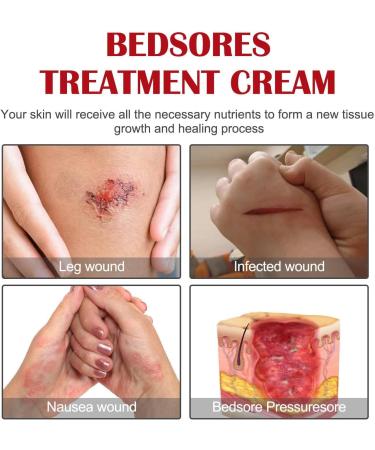  Lambo Bedsores cream for the elderly | Healing Cream Pain Relief 20g Fast-acting healing cream for irritated skin and skin pain Lambo - Buy Online on GoSupps.com