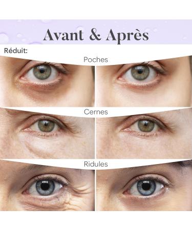 Patch Yeux Anti Cernes (30 paires Jour et Nuit) Masque Yeux avec Caf ine Collag ne et Acide Hyaluronique Patch Anti Cernes Eye Mask pour l'hydratation et les poches Day and Night - Buy Online on GoSupps.com