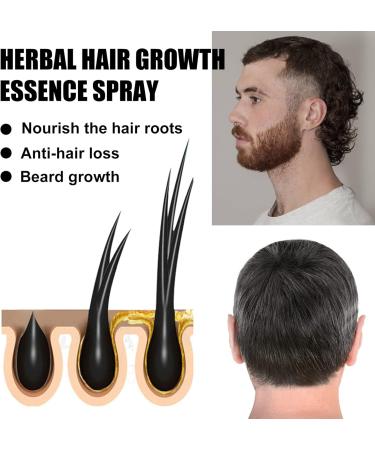 Ginger Germinal Oil Ginger Hair Growth Serum Ginger Essential Oil Stop Hair Loss Hair Thinning Treatment Hair Growth Oil for Women & Men 30ML (2pcs) - Buy Online on GoSupps.com