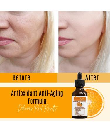 20% Vitamin C Serum - Organic Anti-Aging Facial Serum with Hyaluronic Acid Retinol & Vitamin E - Boost Collagen & Hydrate Skin 1 Fl Oz - Buy Online on GoSupps.com