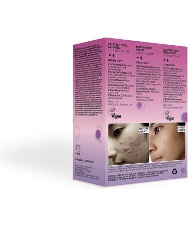 INKEY List Breakout 101 Kit: Salicylic Acid Cleanser, Niacinamide Serum, Succinic Acid Blemish Treatment for Clear Skin | All Ages - Buy Online on GoSupps.com