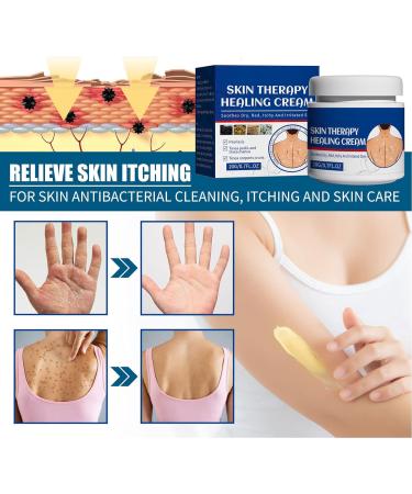 2Pcs 20G Skin Itchy Relief Cream - Soothes Dry, Red, Itchy Skin - Protectant for Tinea Pedis, Corporis, Manus - Buy Online on GoSupps.com
