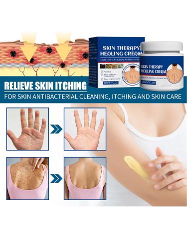 Skin Protectant Psoriasis Relief Cream 2pcs 20g - Soothes Dry, Red, Itchy Skin - Treatment for Tinea Pedis, Corporis, Manus - Buy Online on GoSupps.com