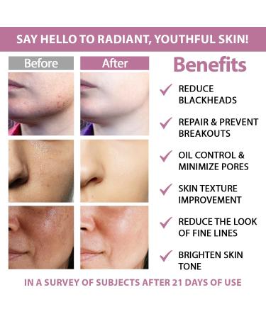 Glycolic Acid 20% & Salicylic Acid 2% Face Exfoliating Pads (50 Count)- Facial Peel Pads for Anti-Aging Cleansing Resurfacing Brightening Blemish Control Revealing Clear Glowing Youthful Skin - Buy Online on GoSupps.com