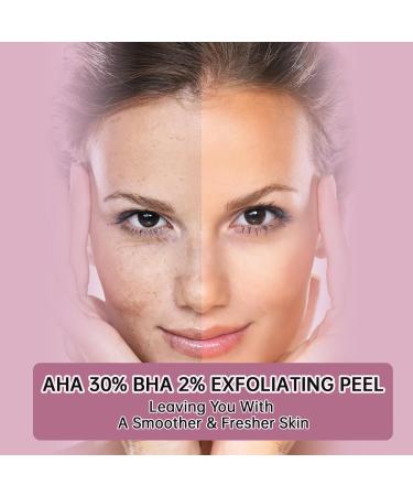 Peeling Solution AHA 30% + BHA 2% | Exfoliating Facial Serum for Acne | Reduce Pores & Fine Lines - 30ML - Buy Online on GoSupps.com