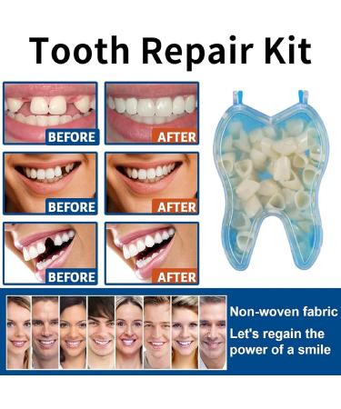 50PCS Temporary Tooth Crown Kit for Front Teeth - Denture Repair & False Tooth Replacement - Buy Online on GoSupps.com