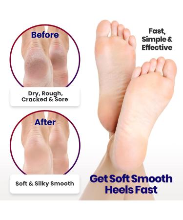 Moisturizing Socks for Men & Women - Aloe Vera Cracked Heel Treatment | Lotion Gel Callus Remover - 2 Pairs X-Large Black - Buy Online on GoSupps.com