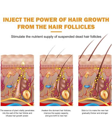 Tongyend Castir Oil Hair Growth Oil Castir Essential Oil Ginger Oil for Hair Growth Rosemary Hair Growth Oil Improve Hair Loss & Nourishes for Women Men-50ML - Buy Online on GoSupps.com