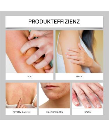  BommFu Soothing Cream for Sensitive Skin Moisturizing and Nourishing Formula Gentle Body Cream 100% Natural Ingredients 140g for Dry Itchy Areas - Buy Online on GoSupps.com