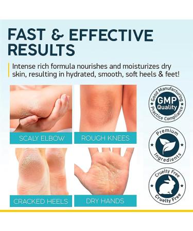 Urea Foot Cream - Urea Cream 40 Percent for Feet - Foot Cream for Cracked Heels and Dry Skin - Cracked Heel Repair Cream - Foot Cream for Feet Knees Hand Deep Moisturizing - Buy Online on GoSupps.com