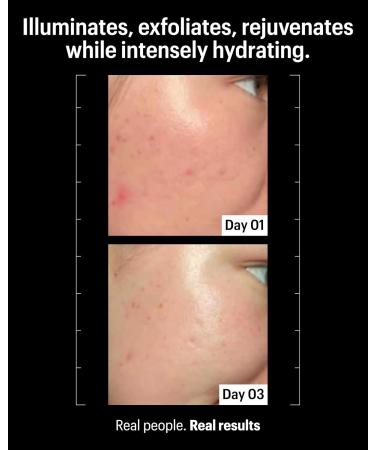 Allies of Skin Multi Acids & Retinoid Sleeping Facial | Exfoliating Overnight Glycolic Acid & AHA Peel | Resurfacing Anti-Aging Treatment For Fine Lines | Unclog Pores and Treat Blackheads 1.6 fl oz - Buy Online on GoSupps.com