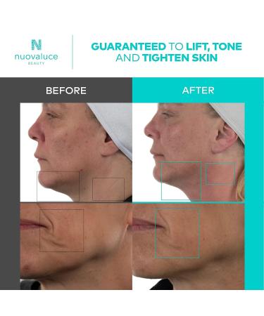 Nuovaluce Anti Aging Microcurrent & Red Light Therapy Device - FDA Cleared for Wrinkle Reduction and Skin Tightening - Handheld Face Toning Machine for At-Home Use - Buy Online on GoSupps.com