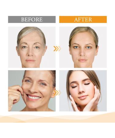 Mingchengheng Fruit Acids For Skin 30ml | Skin Brightening Essence Pore Minimizer | Moisturizing Spot Corrector | Acid Hydrating Liquid Facial Essence For Face Firming Brighten Skin Tone - Buy Online on GoSupps.com