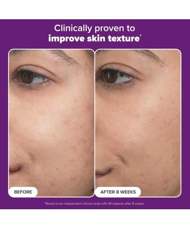 Paula s Choice Pro Retinaldehyde Dual-Retinoid Face Serum Advanced Treatment High Potency Anti-Aging Serum for Face Breakout-Prone Skin Radiance & Rough Bumpy Texture Fragrance-Free Full Size - 1 Fl Oz - Buy Online on GoSupps.com