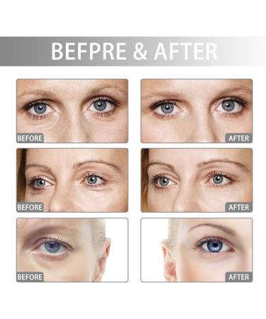 Eye Cream for Dark Circles Anti Wrinkle Eye Cream Anti-Aging Eye Care Products for All Skin Types Eye Repair Cream for Dark Circles Dark Circle Eye Skin Care Firming Eye Cream 2pc - Buy Online on GoSupps.com