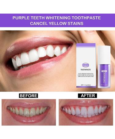 Purple Toothpaste for Teeth Whitening and Stain Removal | Sensitive Teeth Formula | Extra Whitening Gel for Yellow Stain Removal - Buy Online on GoSupps.com