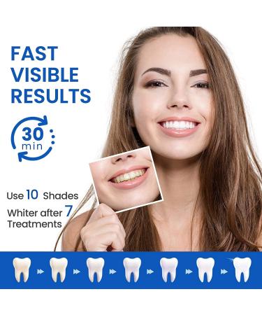  Vinmall 14 strips 28 pieces teeth whitening 5D white professional teeth whitening white teeth strips help eliminate / smoking / coffee / soda / stained wine mint flavor - Buy Online on GoSupps.com