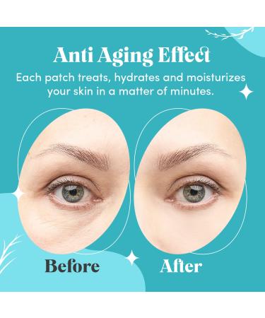 Hydra Blue Collagen Under Eye Gel Mask - Bright Eyes Anti Aging Treatment for Dark Circles, Puffy Eyes, Bags, Fine Lines - 30 Pairs (60 Patches) - Buy Online on GoSupps.com