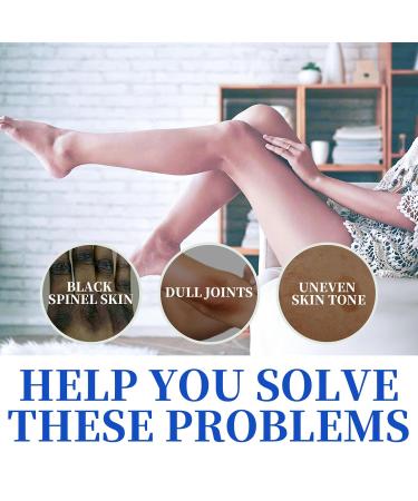 Cremas Para Las Manchas de La Corporales Para Piel Entrepierna Manchas Codos Piernas Zonas ntimas Cara Axilas Rodillas Cuello 50G (2pcs) 1 Fl Oz (Pack of 1) - Buy Online on GoSupps.com