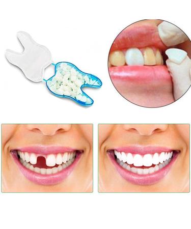 Temporary Tooth Crown Repair Material - Front & Molar Posterior - 2 Boxes (100 pcs) - Fix Missing or Broken Teeth - Buy Online on GoSupps.com