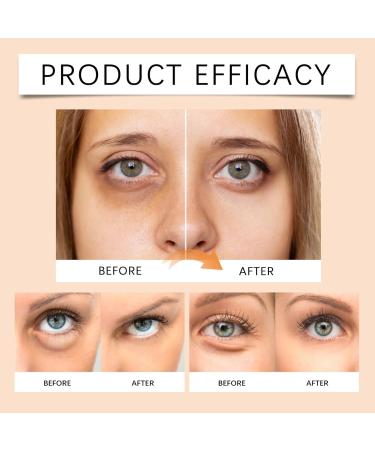 Rice Eye Cream 0.71 fl.oz / 20 ml | Eye Cream | Anti Wrinkle Natural Alternative to Retinol Eye Cream Instant Firm Eyes Anti Dark Circle Eyes Korean Skincare (2) - Buy Online on GoSupps.com