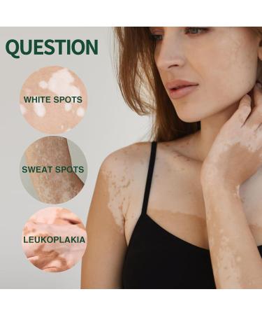 Utapossin Anti-blemish cream delicate herbal extract removes dark spots anti-melanin whitens easy to apply improves skin pigmentation - Buy Online on GoSupps.com