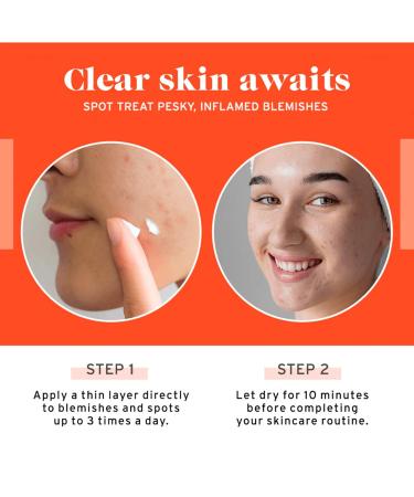 No Bad Stuff - Acne Spot Treatment - Acne Control with 2% Salicylic Acid, Fades Blemishes, with Chamomile, Aloe Vera & Vitamin E (0.5 oz) - Buy Online on GoSupps.com