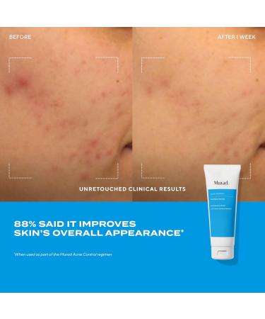 Acne Treatment Trial Kit Salicylic Acid & Mandelic Acid for Clear Skin Oil Control Spot Treatment & Cleanser Travel Size Skincare for Acne-Prone Skin (3-Piece Clear Skin Kit) - Buy Online on GoSupps.com