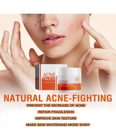 Salicylic Acid Face Moisturizer for Women - Face Cream for Women - Acne Repair Face Cream - Spot Cream for Acne & Pimple - Moisturizer Face with Salicylic Acid - Buy Online on GoSupps.com