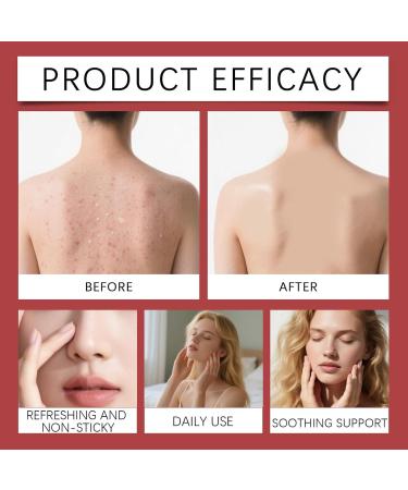  Lexsyn Moisturizing body cream 118 g body care cream anti-dryness moisturizing cream for men and women for stomach travel arms legs home smoother skin - Buy Online on GoSupps.com