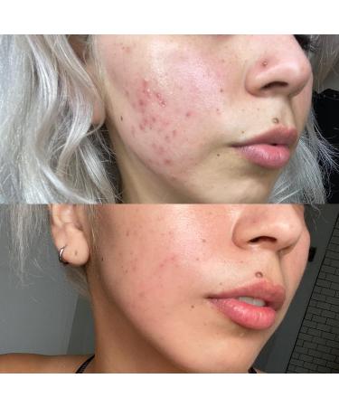 True Botanicals Organic CLEAR Pure Radiance Face Oil | Non-Toxic Natural Skincare (1 fl oz) - Buy Online on GoSupps.com